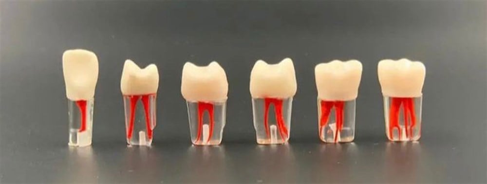 Omega Endodontik Kronlu Kanallı Dişler - Endodontik Eğitim Modeli